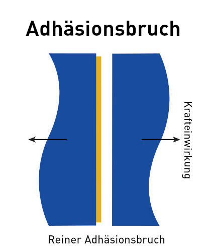 Versagen der Klebeverbindung: Adhäsionsbruch